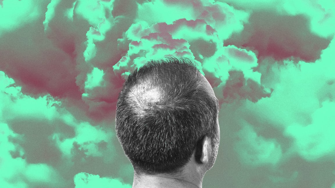 Air Pollution Might be Why You are Going Bald
